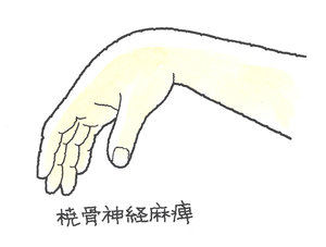 13-4